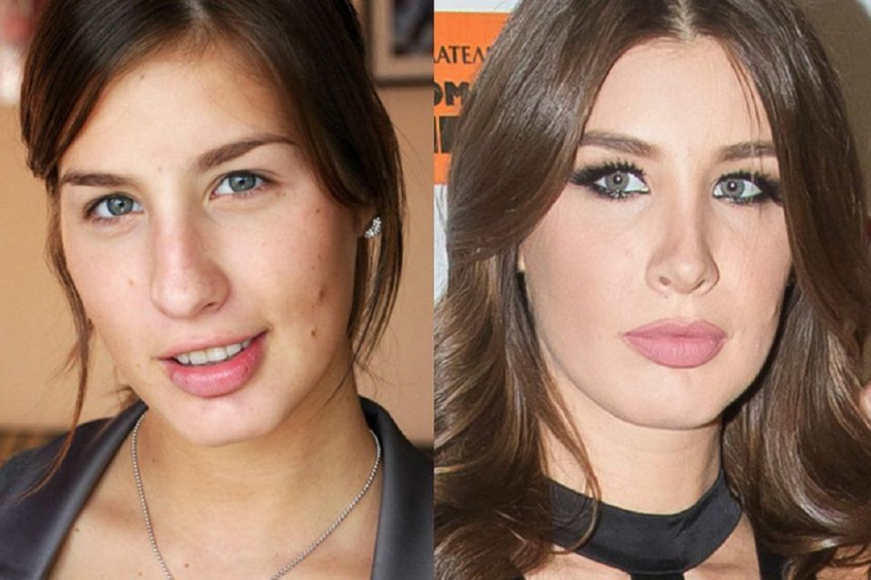 Пластическая хирургия: женщины-звезды, которые стали еще прекраснее и уверенней