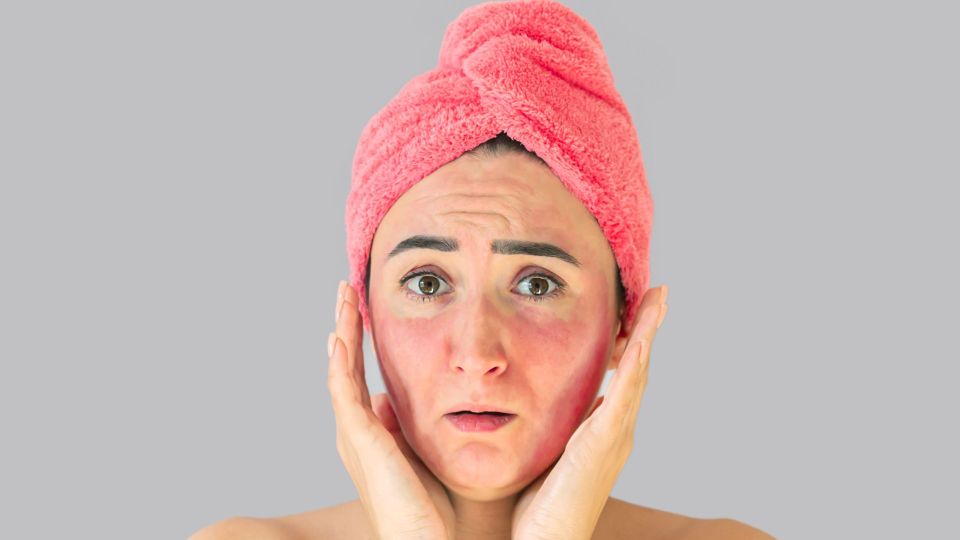 Поплатитесь красотой: никогда не повторяйте эти бьюти-хаки из интернета